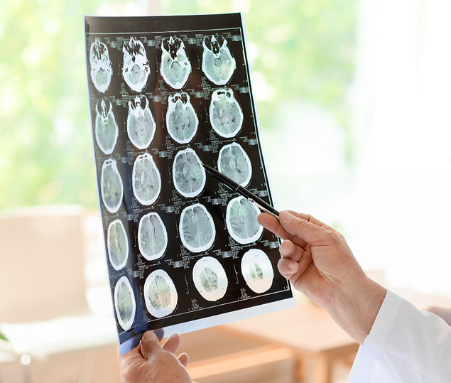 concussion rehab