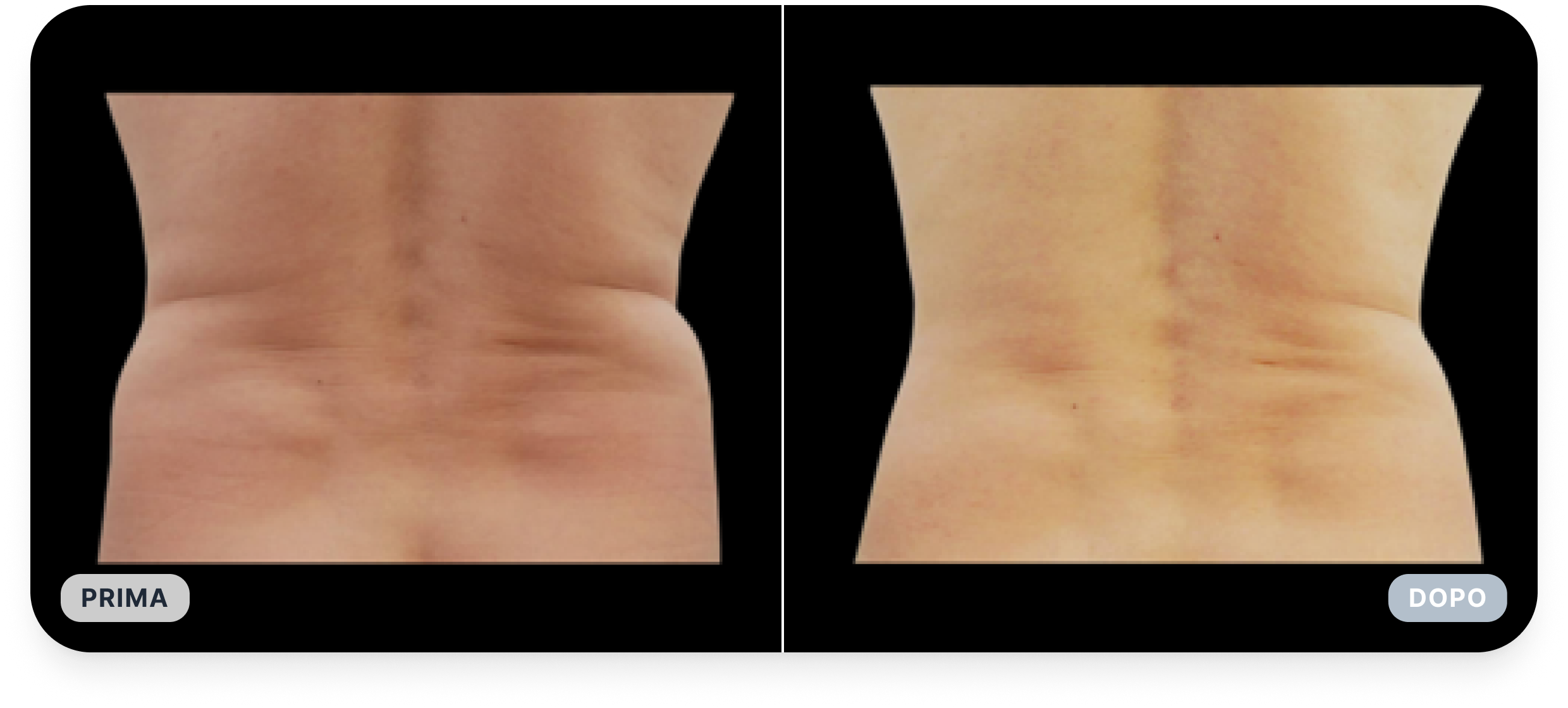 Maniglie amore 2.png