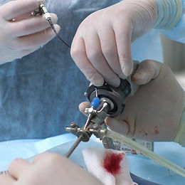 Innovation Imperative: SMART  Laparoscopic Port Technology - the future is now