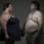 The Psycho-Sexual impact of Bariatric & Metabolic Surgery - Uncovering the Truths