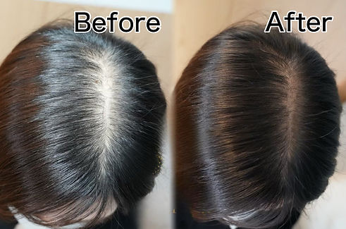 スカルプインクBeforeAfter2