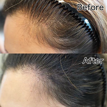 スカルプインクBeforeAfter５