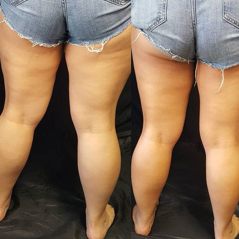 Complexions by Misty is an esthetician in Bakersfield California offering spray tanning