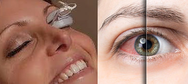 Lipiflow.jpg
