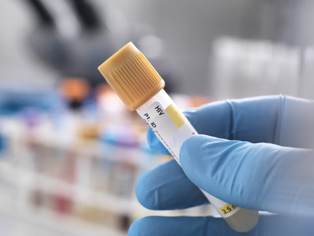 Mulher pode se tornar o terceiro caso de cura de HIV no mundo