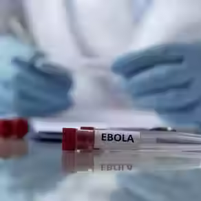 RS investiga caso suspeito de Ebola em paciente atendido em Novo Hamburgo