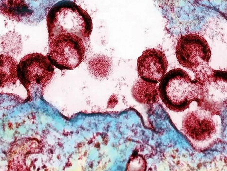 Variante do HIV mais transmissível e agressiva é encontrada na Holanda