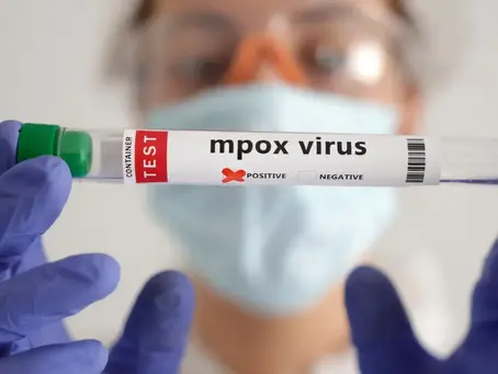 Mpox: África tem quase 50 mil casos confirmados