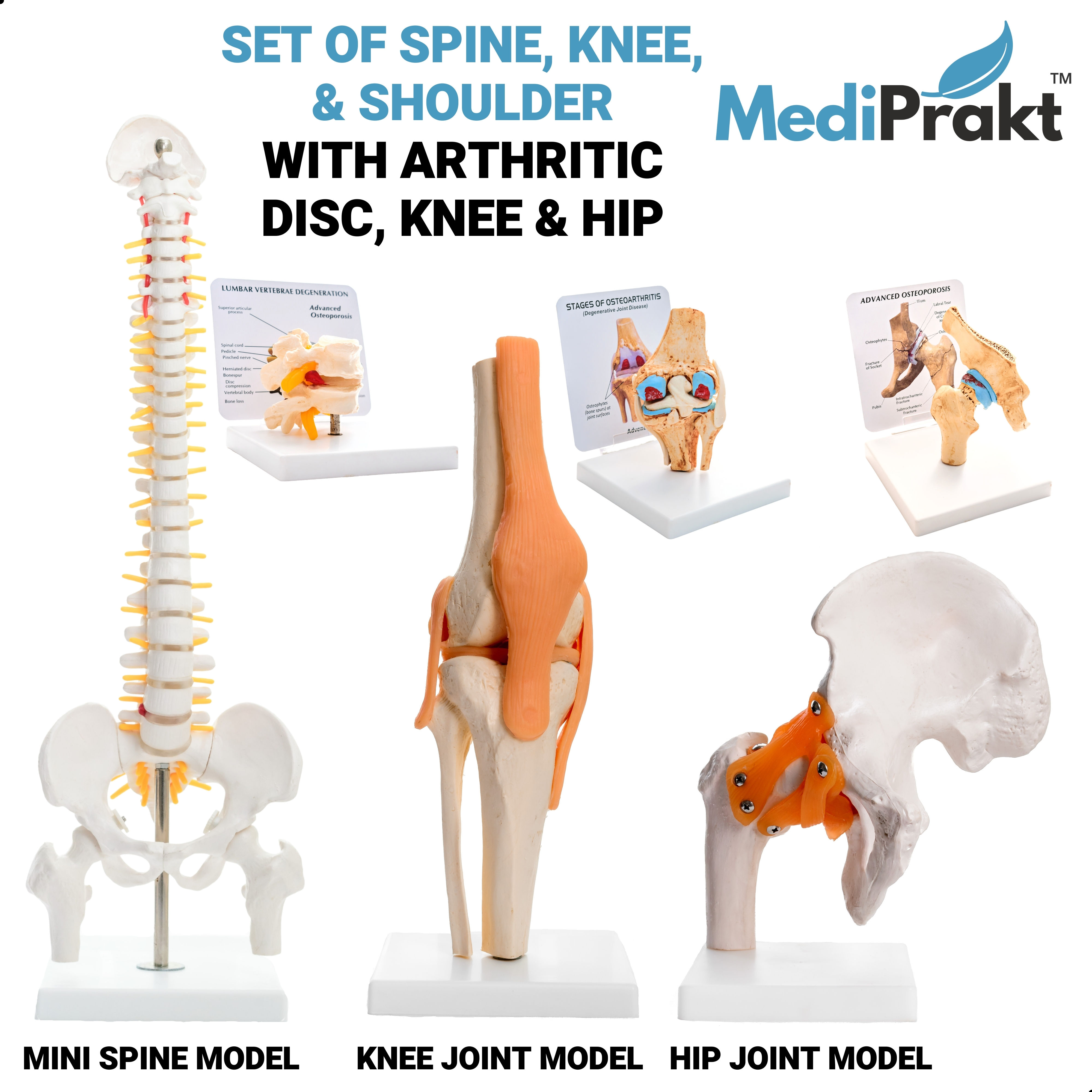 Set of 3 with Advanced Arthritis HIP, KNEE MODEL & SPINE Disc Degeneration MODEL