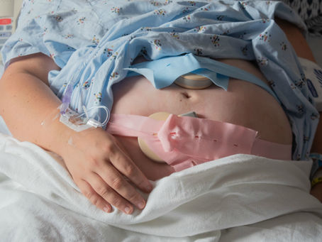 Birth Story of Ella Rose