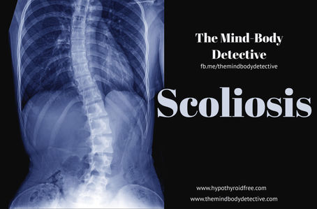 Scoliosis