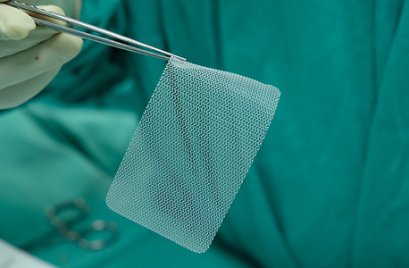 Synthetic Mesh for Inguinal Hernia Repai