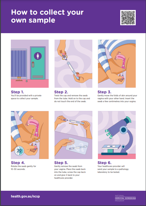 Instructions on how to collect your cervical screening test sample at home