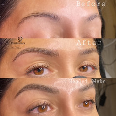 Before-After-Healed