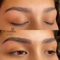 Before-After
