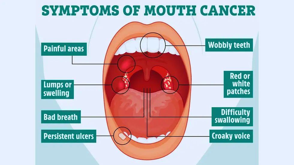 Illustration showing key symptoms of mouth cancer inside the oral cavity, including ulcers, lumps, red or white patches, and difficulty swallowing.