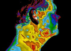 lung-stage-image-revised.jpg
