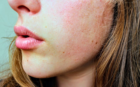 Sebum Control Cream for Face in Canada: Zero Shine