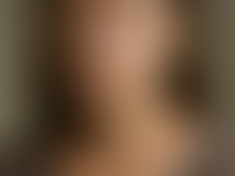 Am Hals einer Mittelalten Frau sieht mal Skin Tags und einen müden Gesichtsausdruck