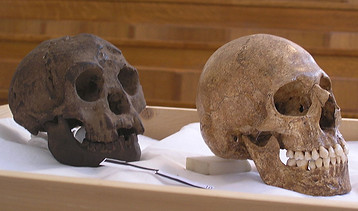 1024px-H-floresiensis-Cretan-microcephalic.jpg