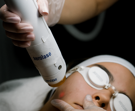 Aerolase Laser Facial
