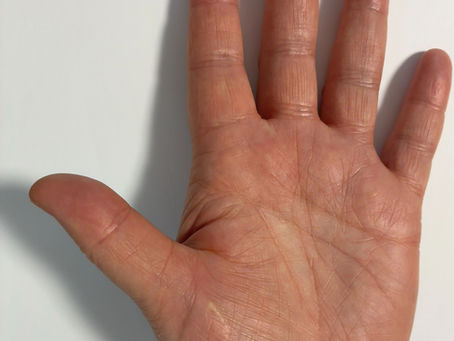 Understanding Hand Surgery: What You Need to Know