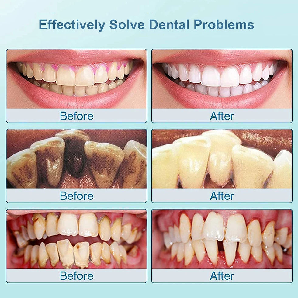 Miniature : Ultrasonic Dental Teeth Plaque Remover & Cleaner