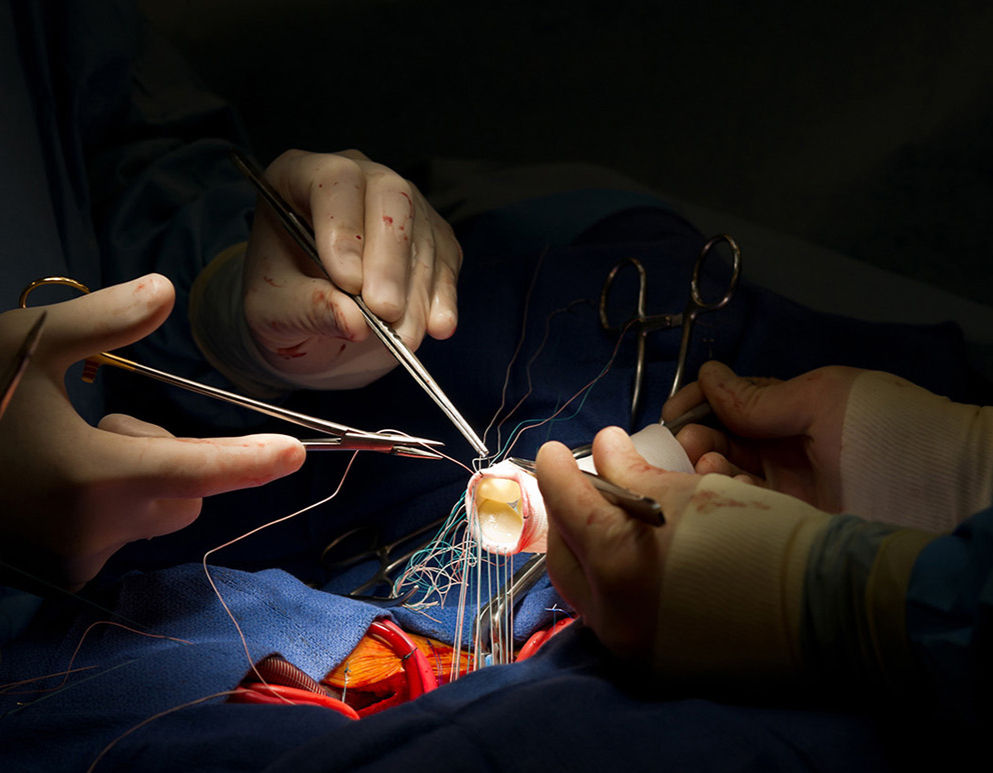 Paquete Cardiovascular