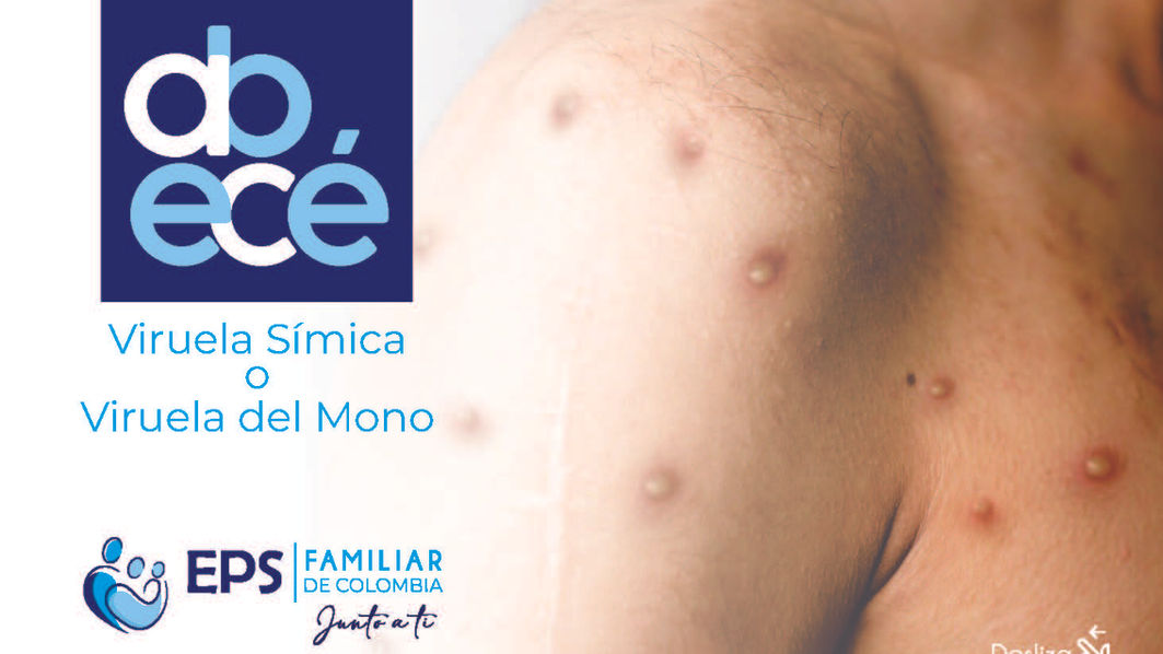 abece Viruela del Mono_Página_1.jpg