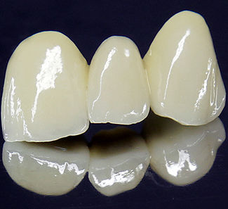 ZircoDentalL2_-_600px (3).jpg