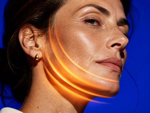 Profilo di donna con archi luminosi che simboleggiano la radiofrequenza viso a Lecco
