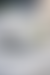 Come eliminare occhiaie e sguardo stanco