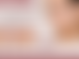 Trucco paramedicale per vitiligine: prima e dopo, risultati reali e errori da evitare