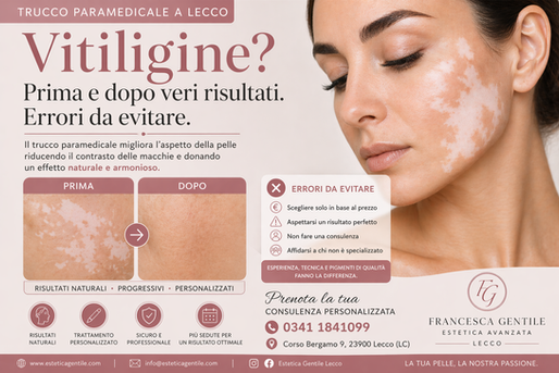 Trucco paramedicale per vitiligine: prima e dopo, risultati reali e errori da evitare