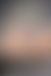 Tricopigmentazione prima e dopo: cosa aspettarsi davvero