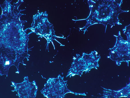 Why is Cancer increasing under the age of 50?
