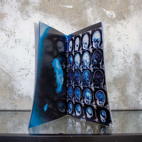 Multiple blue MRI brain scans displayed