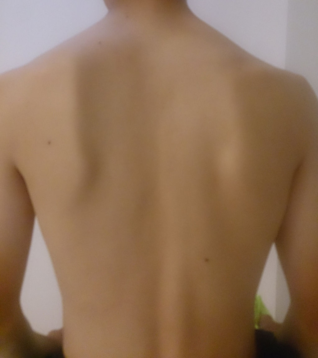 阿見町のしみず整骨院 ケガ 交通事故治療はおまかせください