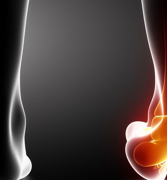 SOFT TISSUE INJURIES .... A PAIN IN THE ?????