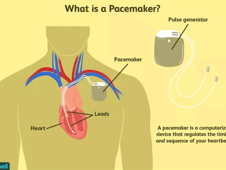 Cyber Security for Cardiac Devices