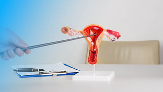 doctor-gynecologist-pointing-model-female-reproductive-system-his-desktop (1).jpg