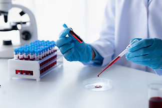 lab-assistant-medical-scientist-chemistry-researcher-holds-glass-tube-through-blood-sample