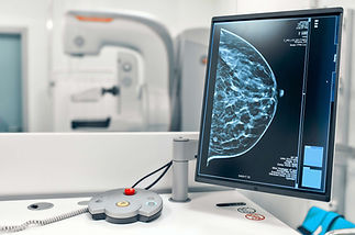 mammogram-snapshot-breasts-female-patient-monitor-with-undergoing-mammography-test-backgro