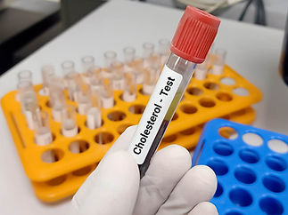 biochemist-doctor-holds-blood-samples-cholesterol-test (1).jpg