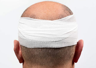 close-up-man-head-wrapped-with-bandage-with-white-background (1).jpg
