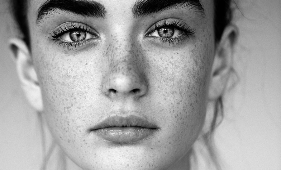 Black and White Image of a Girl with Freckles, looking into the camera 