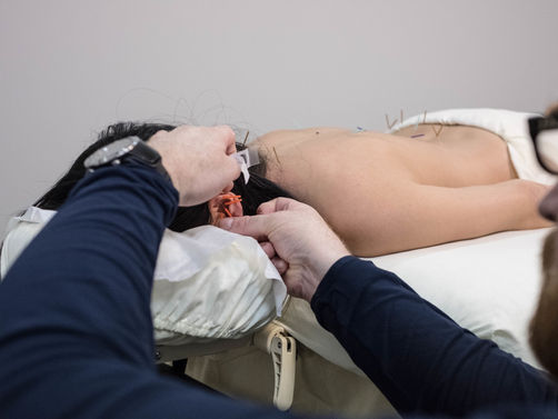 Auriculotherapy (Ear Acupuncture) Versus Acupuncture, which one is better for me?
