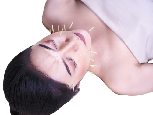 Botox Versus Cosmetic Acupuncture: An Evaluation of Efficacy and Safety