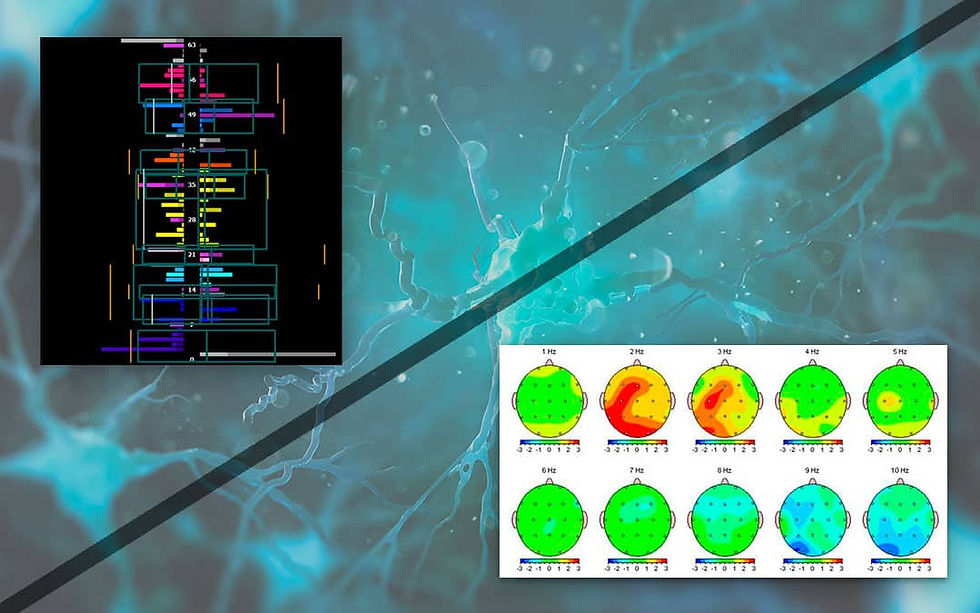 Neurofeedback DYNAMIQUE ou LINÉAIRE