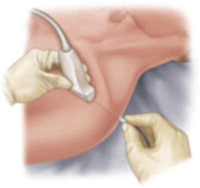 211985_1_En_23_Fig5_HTML.png